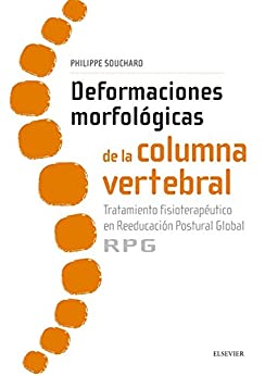 Deformaciones morfológicas de la columna vertebral: Tratamiento fisioterapéutico en reeducación postural global RPG