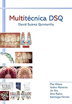Multitécnica de Ortodoncia DSQ: El futuro de la Ortodoncia