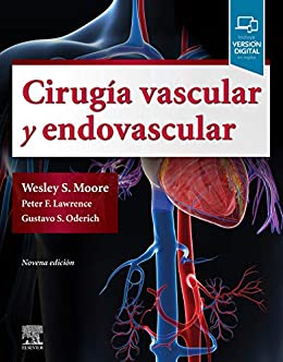 Cirugía vascular y endovascular: Una revisión exhaustiva