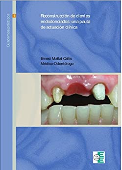 Reconstrucción de dientes endodonciados: Pautas de actuación clínica